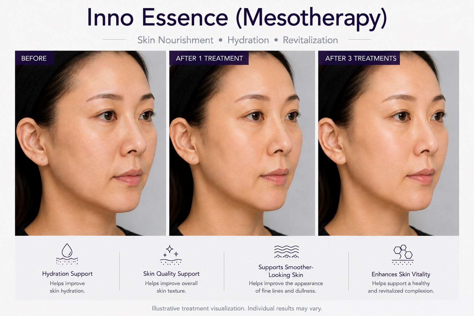 Before and After Inno Essence Mesotherapy