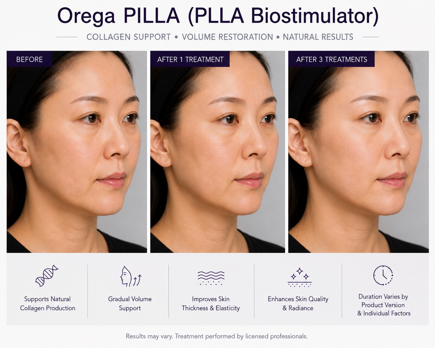 Before and After Orega PLLA